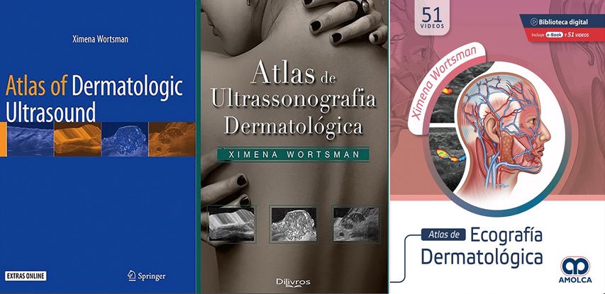 xworts's tweet photo. Glad to announce the publication of the translation to Spanish of the book Atlas of Dermatologic Ultrasound by the Amolca Publisher, which has been added to the English and Portuguese versions. @EAmolca @xworts @sonoskin
#dermatologicultrasound #skinultrasound #nailultrasound https://t.co/8vMhWXOkTc
