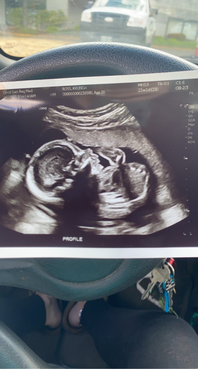 Kyleigh_ross7's tweet photo. she’s already started cheering. THATS MY GIRL. with her little foot in the air 😂❤️ oh this momma can’t wait to hold you 😍❤️ https://t.co/vW2zjt6AQx