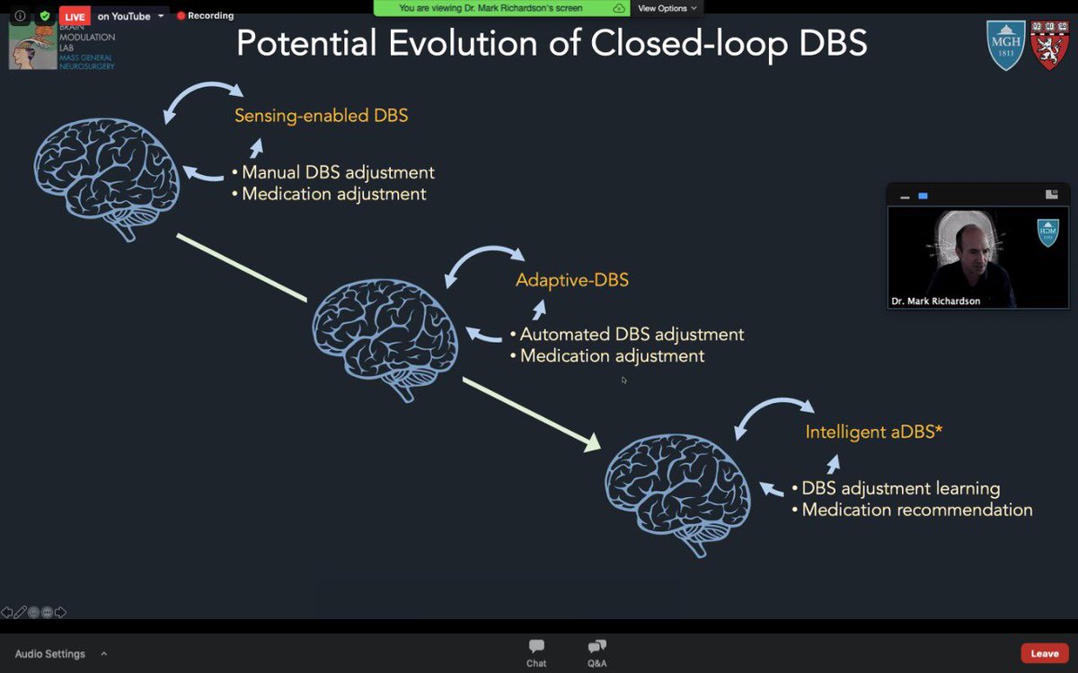 cienhus's tweet photo. Dr. Mark Richardson is sharing his lecture in 2021-IWBNC right now 🤓
Join us in https://t.co/qsx4hFbtq7

Full agenda on: https://t.co/NS2xELwxoP
#Neurosurgery #MedEd https://t.co/UvDPAYqBry
