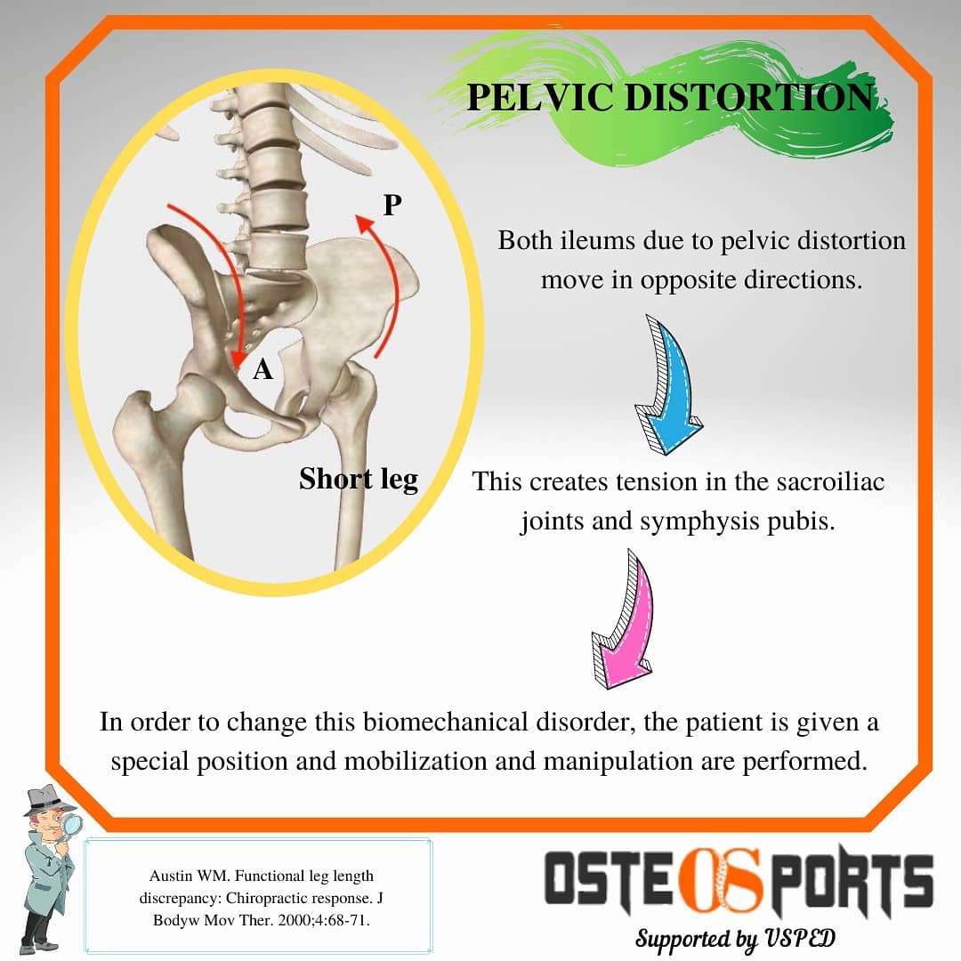 Osteosports (@osteosportscom) on Twitter photo 