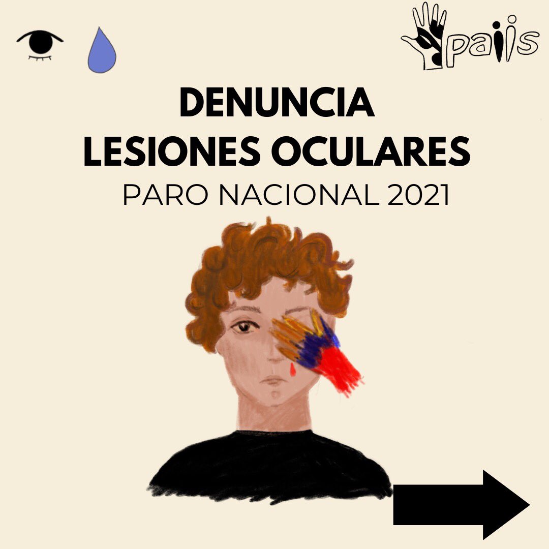 PaiisUniandes's tweet photo. 🔴A un mes de inicio del #ParoNacional lanzamos este canal para denunciar la ocurrencia de lesiones oculares por violencia en la represión del derecho a la protesta. #QueQuienesNosCiegasNosLloren 
@TembloresOng 
@CIDH @onucolombia @UniandesDerecho @elespectador https://t.co/UAWsJVVfhP