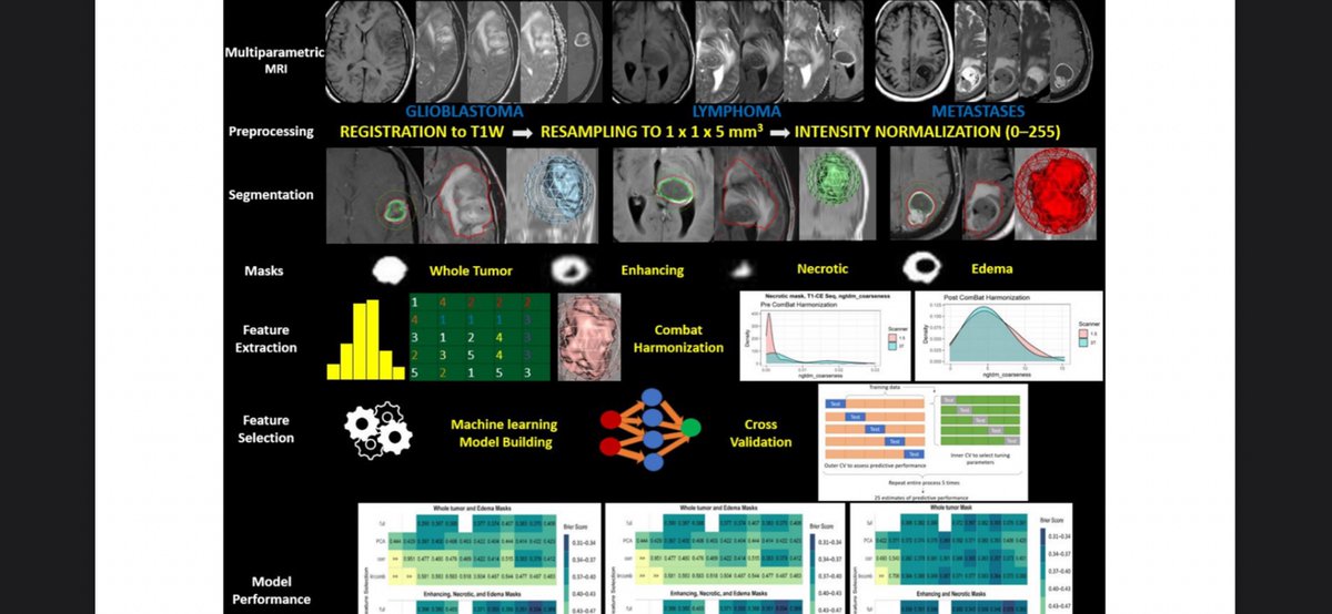 Check our latest radiomics paper- We evaluated use of MRI radiomics for a three tumor class Problem in Neuro-Oncology unlike commonly tested two tumor subtypes only.  Time to Test the Waters. doi.org/10.3390/cancer… #mdpi <a href="/IowaRAD/">University of Iowa Radiology</a> <a href="/uiowa/">University of Iowa</a> #Cancers