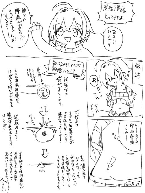 日帰り手術してきたよ〜 