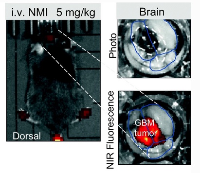 Published our research showing imaging details of a theranostic molecule targeted to brain cancer:
Near-Infrared Monoamine Oxidase Inhibitor Biodistribution in a Glioma Mouse Model pubmed.ncbi.nlm.nih.gov/33709330/