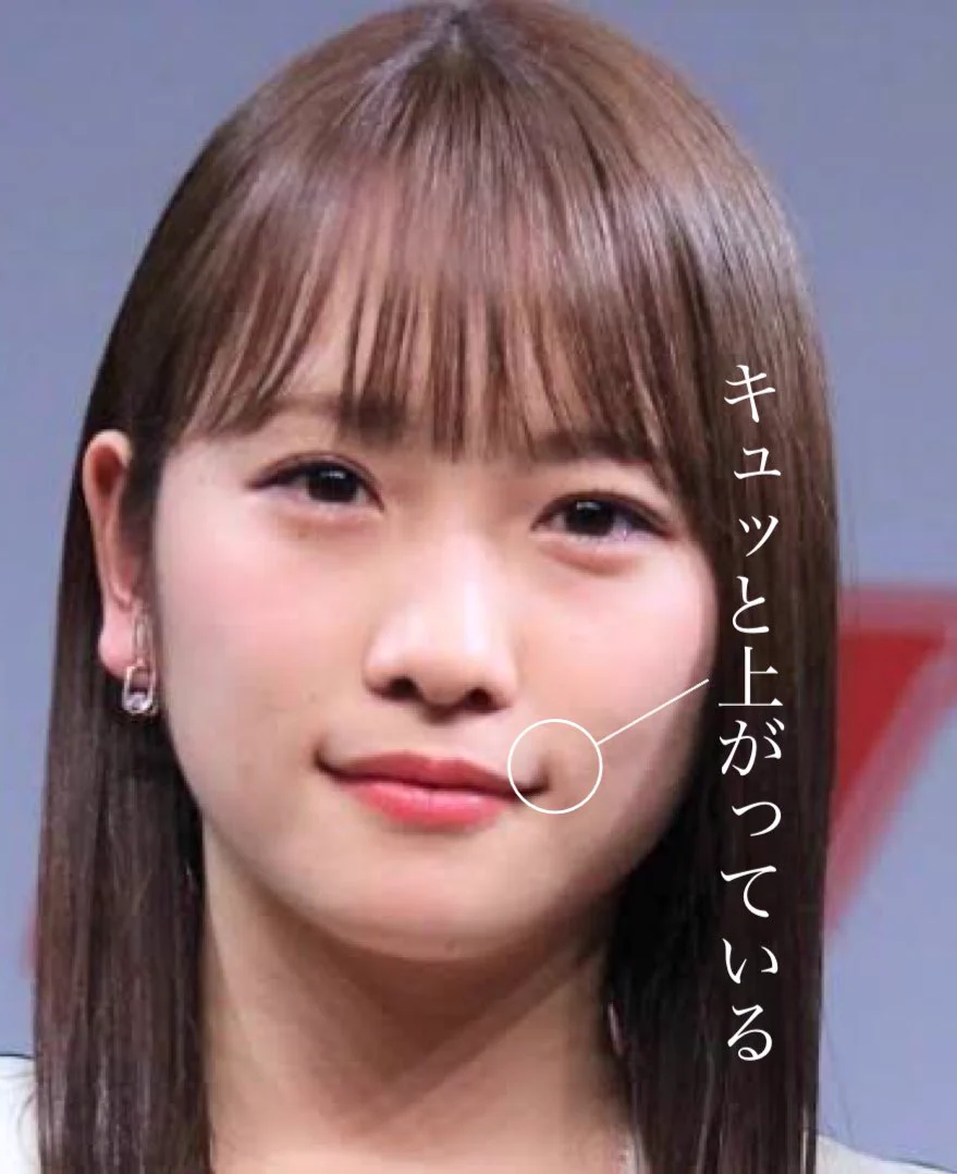 川 栄 李 奈 整形