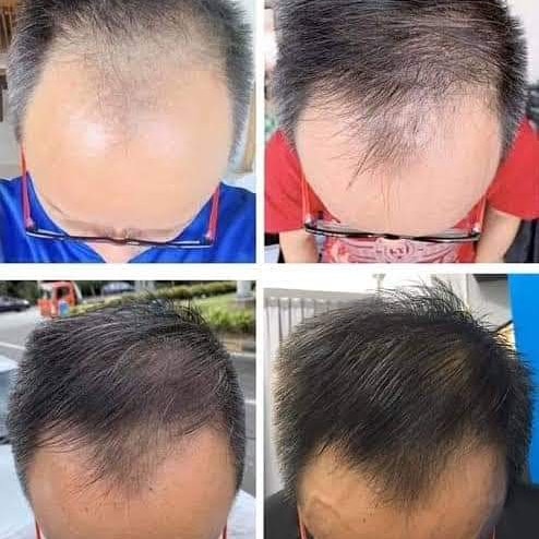 meduffield's tweet image. Check out the AGELOC NUTRIOL SCALP &amp;amp; HAIR SYSTEM! 
Clinical results:
💥 72% fewer broken hairs!
💥107% more volume!
💥106% softer hair!
💥 84% more shine!
💥 90% of subjects said their hair had improved in:
VOLUME
THICKNESS
SOFTNESS
SHINE
HEALTHY APPEARANCE
Comment below or inbox