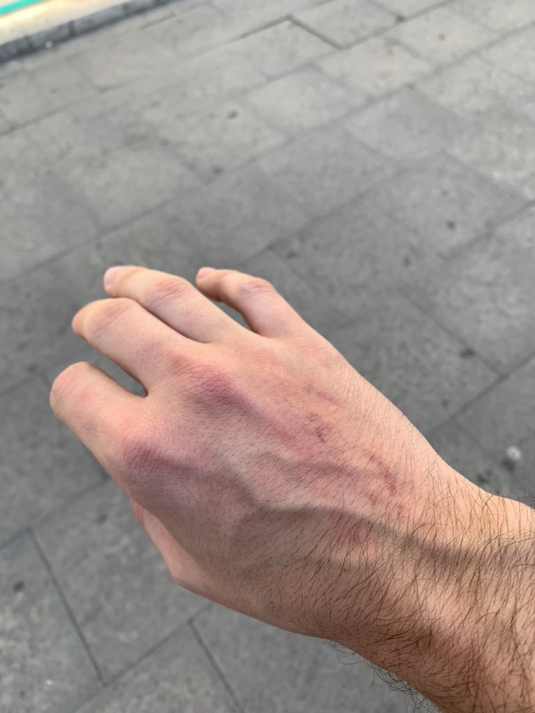 marcmagt's tweet photo. Acabo de sufrir una agresión. A las 9AM. Me crucé con un grupo de hombres por la calle que se ríen (claramente de mi), se acerca uno, me dice algo que no escucho (auriculares) y me da una patada en la mano y se van. Por suerte no fue nada. Me pegaron por maricón? Most likely. https://t.co/237EbRfRdB