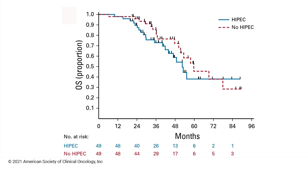 Journal of Clinical Oncology (@jco_asco) on Twitter photo HIPEC with carboplatin during secondary cytoreductive surgery in women with recurrent ovarian cancer did not improve outcomes fal.cn/3fIXK #JCO #gyncsm <a href="/ROCearbhaill/">Róisín O’Cearbhaill</a> <a href="/zivanovicmd/">Oliver Zivanovic</a> <a href="/TeamOvary_MSK/">Team Ovary, Memorial Sloan Kettering Cancer Center</a> HIPEC with carboplatin during secondary cytoreductive surgery in women with recurrent ovarian cancer did not improve outcomes fal.cn/3fIXK #JCO #gyncsm <a href="/ROCearbhaill/">Róisín O’Cearbhaill</a> <a href="/zivanovicmd/">Oliver Zivanovic</a> <a href="/TeamOvary_MSK/">Team Ovary, Memorial Sloan Kettering Cancer Center</a>
