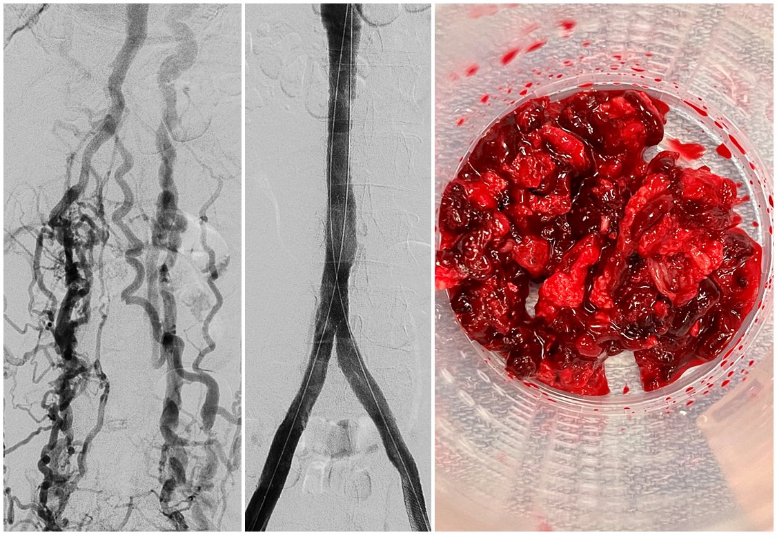 Jeffrey F. B. Chick, MD, MPH tweet media