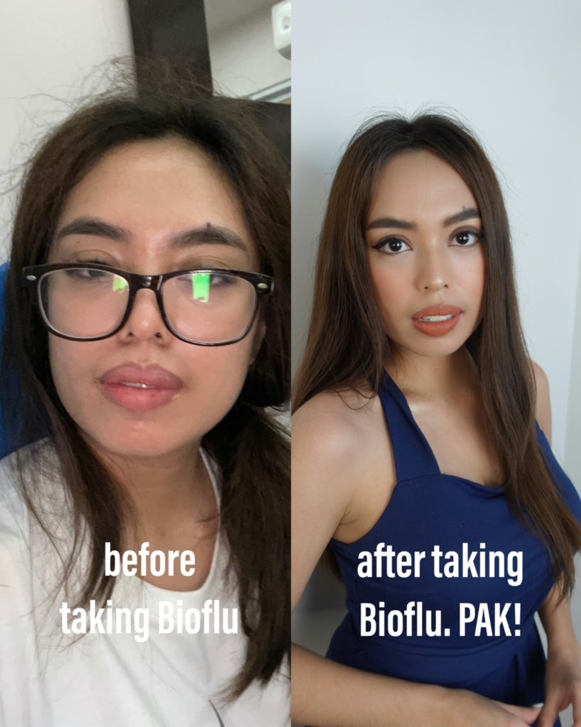 heyhersheyy's tweet photo. Juggling work & grad school isnt easy. Pagod na nga katawan ko sa shoots, pagod pa utak ko sa papers. Minsan, humihina immune system ko at nagkaka sipon at ubo (hirap magkaubo nakaka praningπ)
Kaya I take Bioflu agad para tuloy ang career! π#ThankYouBioflu #BabangonKaSaBioflu https://t.co/KI1p3gjEzp