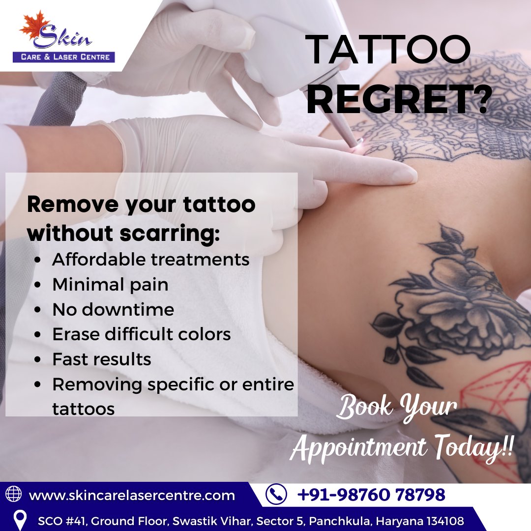 Fastest Laser Tattoo Removal in Sydney for Tattoo Regret