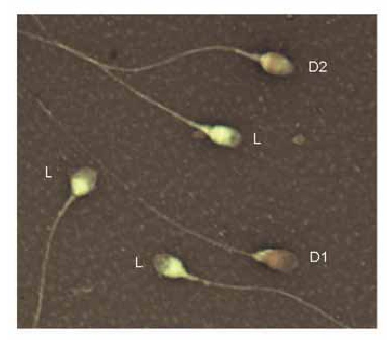 بعد ما خلصنا
One of the critical steps in semen analysis
ألا وهو خطوة ال motility
يهمنا نعرف ال non motile sperms
دول
هل هم non motile فعلا
وللا هم dead = ميتين
