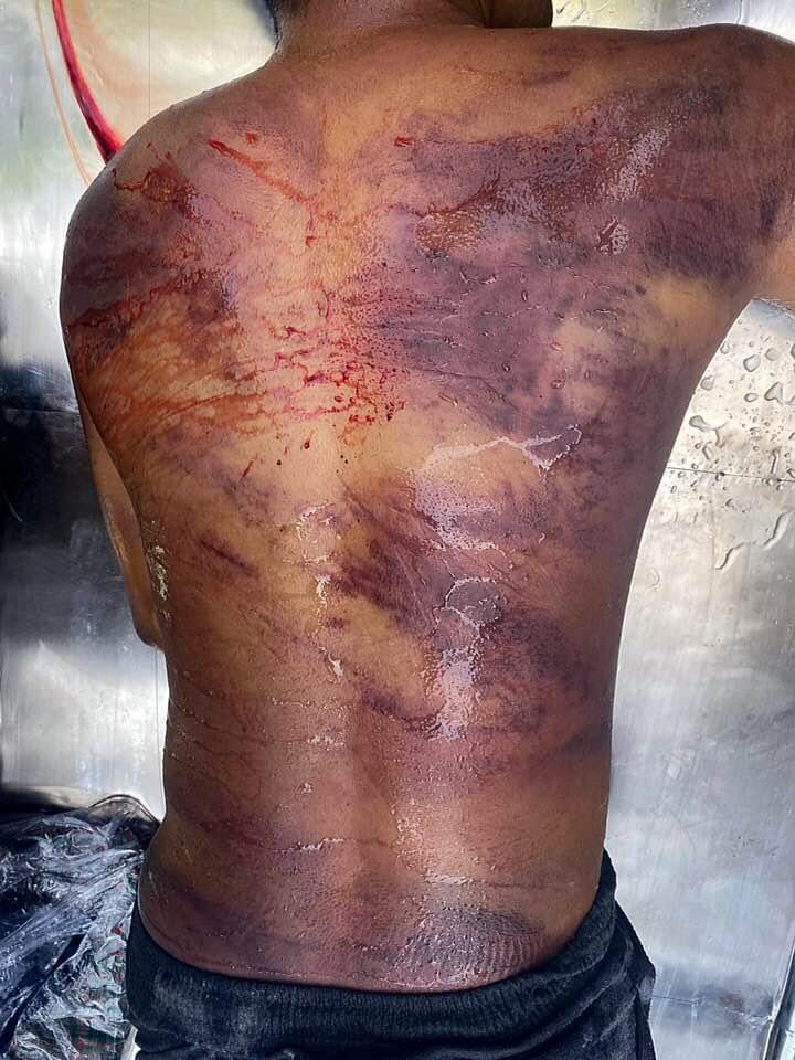 Police in Myanmar arrested Ko Min Min on Monday and called his wife on Tuesday to collect his body. Authorities said that he died as a result of “lung problems,” despite being covered in bruises and what appeared to be knife wounds.
#WhatsHappeningInMyanmar