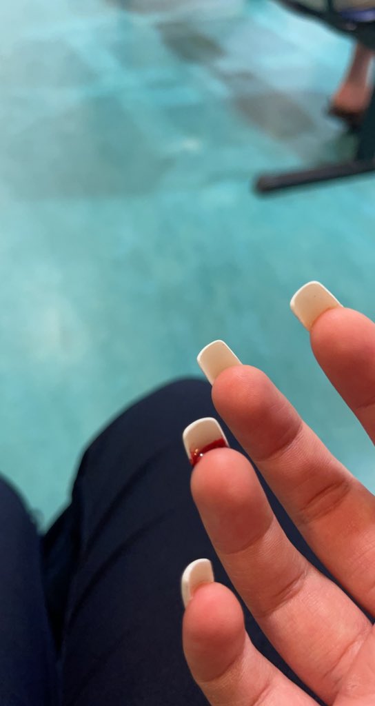 EmmaColledge's tweet image. I’ve been put off acrylics for life🤢gels for me from now on😭