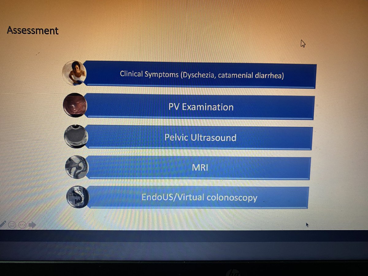 TheFemas's tweet photo. Mesmerising video presentation on #RectoVaginalEndometriosis #FatBelongsToBowel #RectalShaving as we #dissect approach the #RectoVaginalSpace  at #Femas3PointZero @TheFemas #OneDay #InternationalWorkshop  in assoc. with @gchysteroscopy @harofe64 #HospitalsApollo Convener @Niru22 https://t.co/YRmtunAHvO