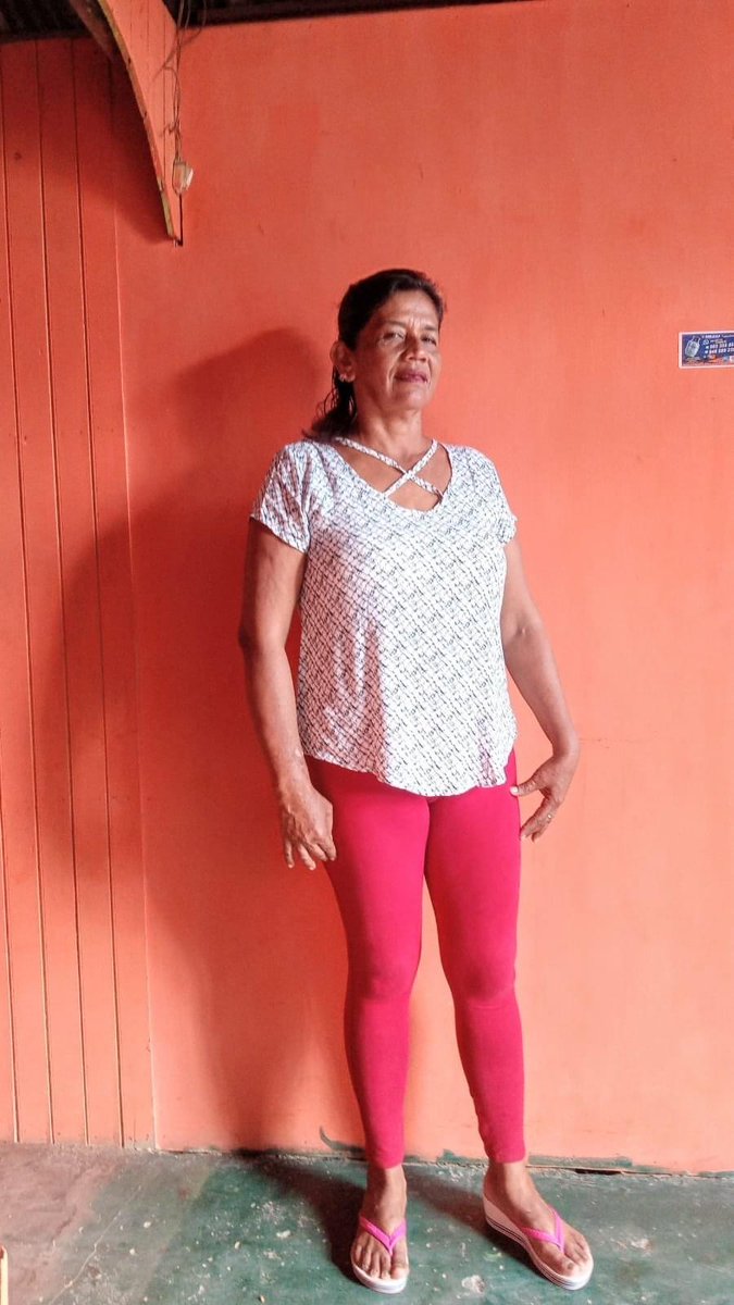 ProyectoVASI's tweet photo. Read Mariela's story on our Facebook page, https://t.co/MbzzrC5UlJ. Lean la historia de Mariela en nuestra página de Facebook: https://t.co/MbzzrC5UlJ

#healthcareworkers #COVID19 #amazonia #vasicommunity #profesionalesdelasalud #COVID19 #amazonía #comunidadvasi https://t.co/gxooNMoG59