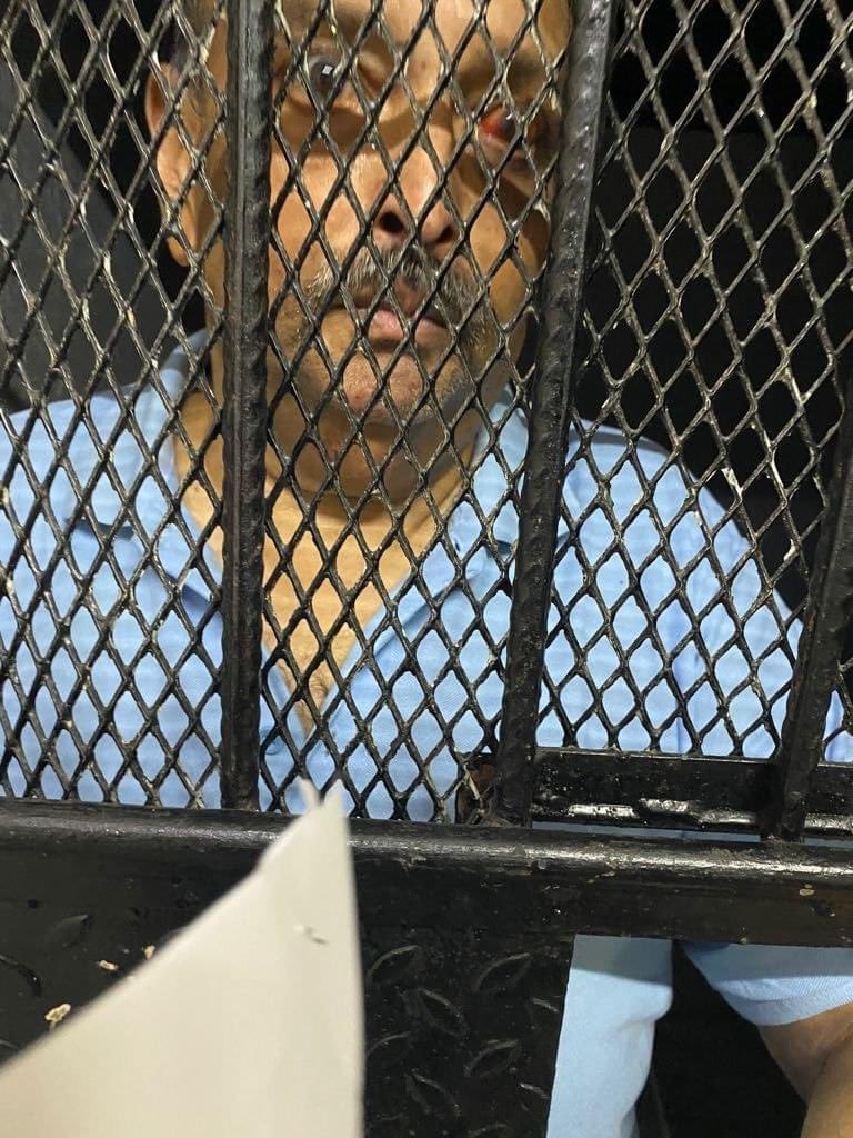 ANI's tweet image. First photo of fugitive diamantaire Mehul Choksi in police custody in Dominica

(photo - Antigua News Room)