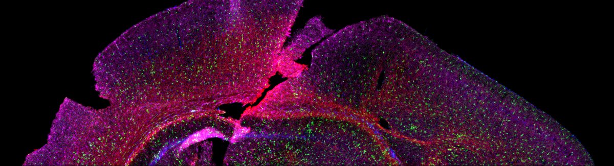 Microglia, myelin and oligodendrocyte progenitor cells!