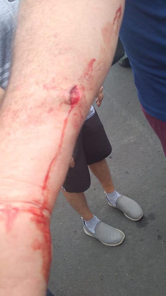 gemitacega's tweet photo. Urgente!! @LassoGuillermo @CJudicaturaEc @FiscaliaEcuador @eluniversocom @EcuavisaInforma sin cumplirse 24 horas, el juez Raúl Villamil deja en libertad a persona “limpiaparabrisas” que apuñalo a mi padre  el día de ayer en Portoviejo. https://t.co/XycVjhUpHV