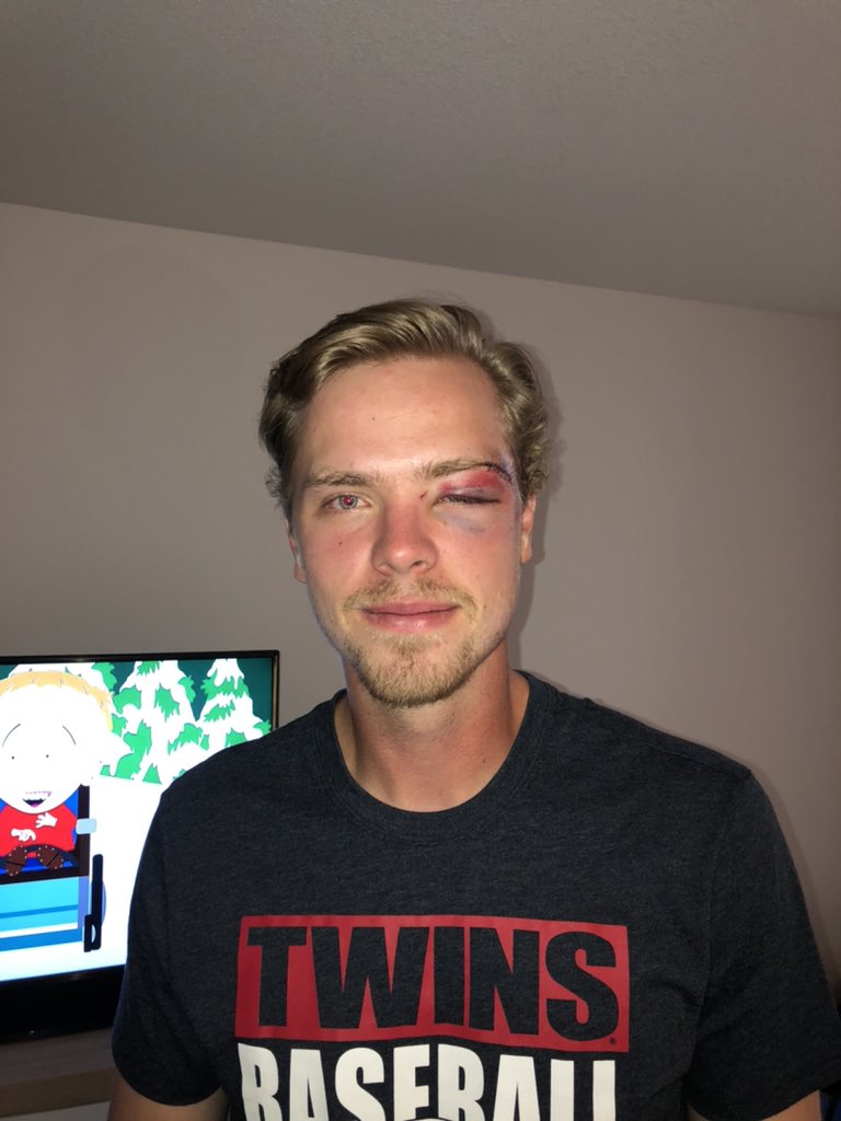haggs33's tweet photo. He’s chillin https://t.co/q67HS03bYf