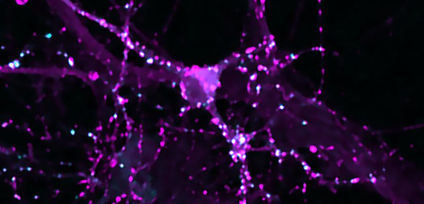 scisignal's tweet photo. In vitro experiments show that #leptin boosts the expression of #GABAA receptors and supports GABAergic #synaptogenesis in hippocampal neurons. The results reveal further complexity in leptin receptor signaling and its interactome. @WSUPullman https://t.co/MSQcqmTyx6 https://t.co/ucE7I3Xoo8