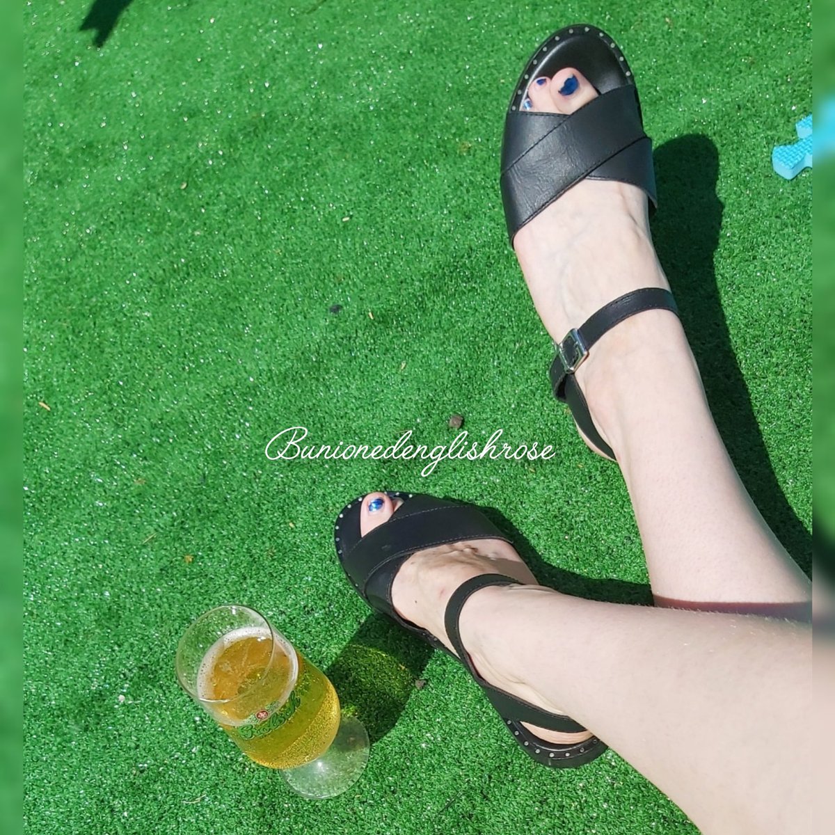 bunioned's tweet photo. #bunionpain #bunionfeet #bunionbabes #bunions #bunionkink #bunionlove #bunion #longtoes #pedicure #pedi #paintednails #footfetish #toelovers #toefetish #feet #foot #creamyfeet #crossedtoes #halluxvalgus #hammertoes #skinnyfeet #europeanfeet  #smellyfeet #smellyfeetlovers https://t.co/3Crhf9NbuG