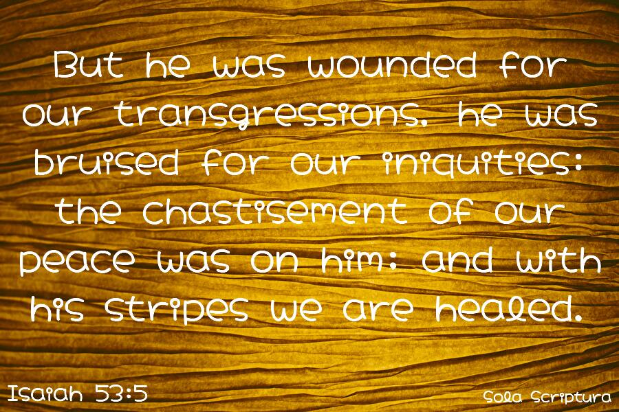 ScripturaSpace's tweet image. But he was wounded for our transgressions, he was bruised for our iniquities: the chastisement of our peace was on him; and with his stripes we are healed.
Isaiah 53:5
solascriptura.space/en/kjva/is/53/…