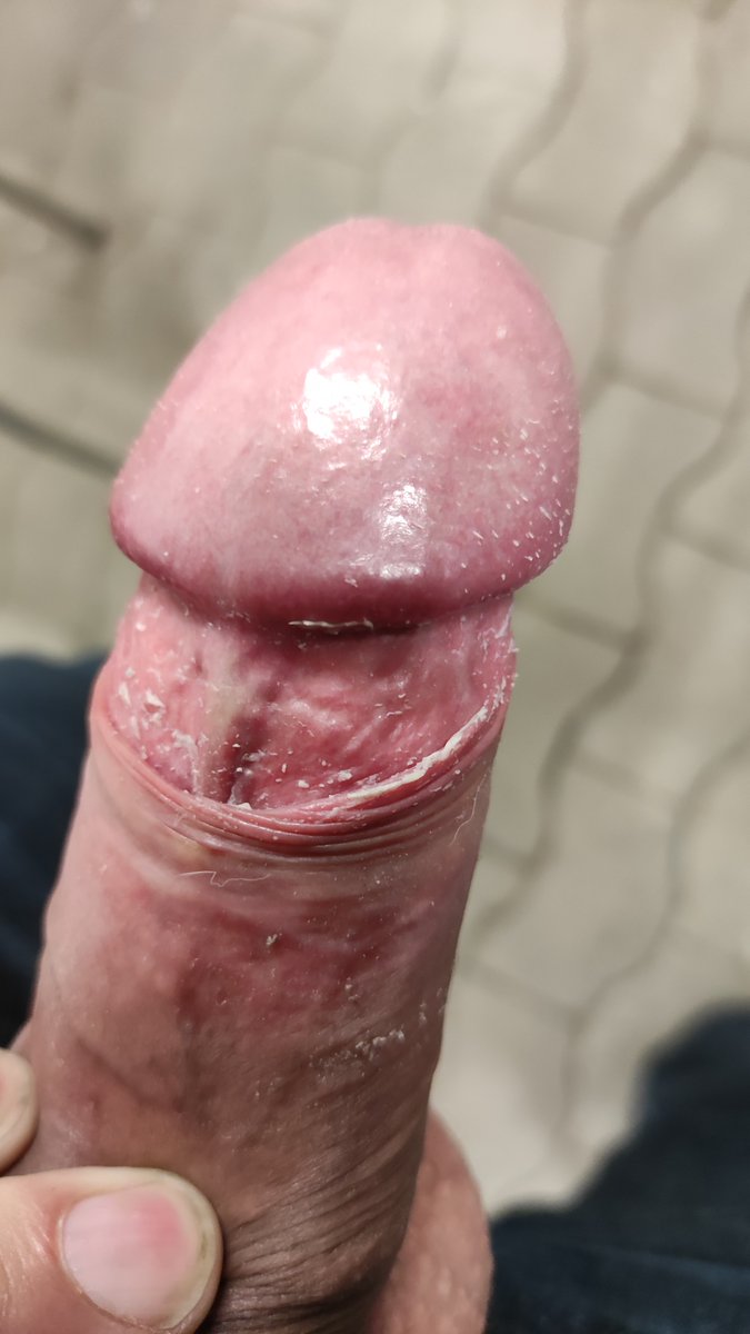 Eornad1's tweet photo. #cock #dick #dirty #smegma #foreskin https://t.co/trNroulg9v