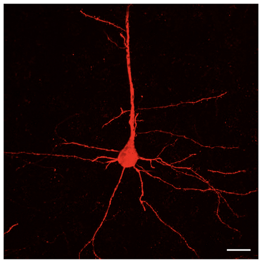 Look how beautiful they are.
These are the UMNs, which were once diseased and we made them healthy again by directed gene delivery!