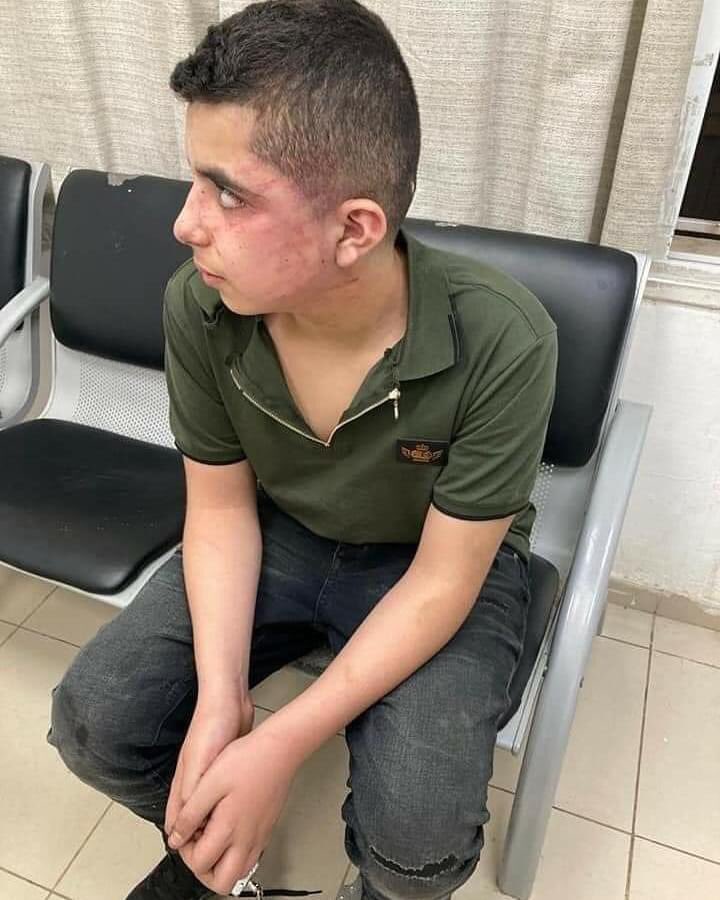 14 yo child Mohd Hajj Yahya fmAl Tayybeh town was detained & brutally beaten by Israeli police during large Israeli detention campaign against Palestinians.His family denied visits & Israeli military extends his detention every 3 days

14 yo..Complicated ? 
Source: Palestine eye