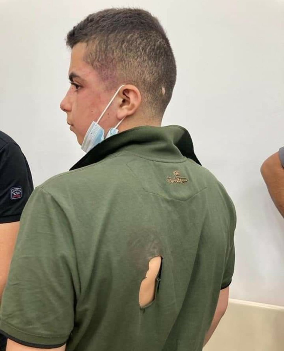 Someone50962368's tweet photo. 14 years old child Mohammed Hajj  from Al Tayybeh town in 1948- occupied Palestinian territories, he was detained and brutally beaten by occupation police during the large Israeli detention campaign against Palestinian.
#PalestineWillBeFree
#انقذوا_حي_الشيخ_جراح 
#انقذوا_سلوان https://t.co/jiusLmzVNr