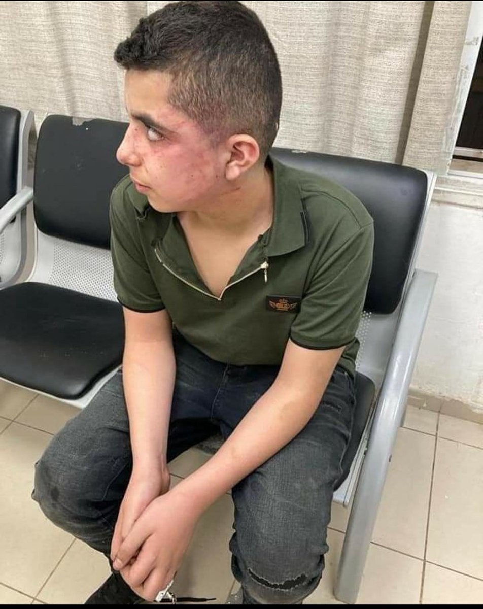 Someone50962368's tweet photo. 14 years old child Mohammed Hajj  from Al Tayybeh town in 1948- occupied Palestinian territories, he was detained and brutally beaten by occupation police during the large Israeli detention campaign against Palestinian.
#PalestineWillBeFree
#انقذوا_حي_الشيخ_جراح 
#انقذوا_سلوان https://t.co/jiusLmzVNr