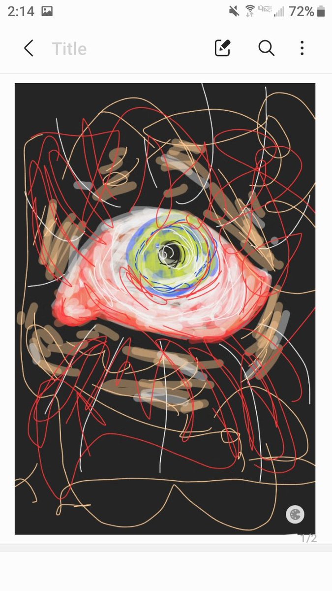 sugar_t33th's tweet photo. yuck 

eyeball time https://t.co/m0NWSDKwYo