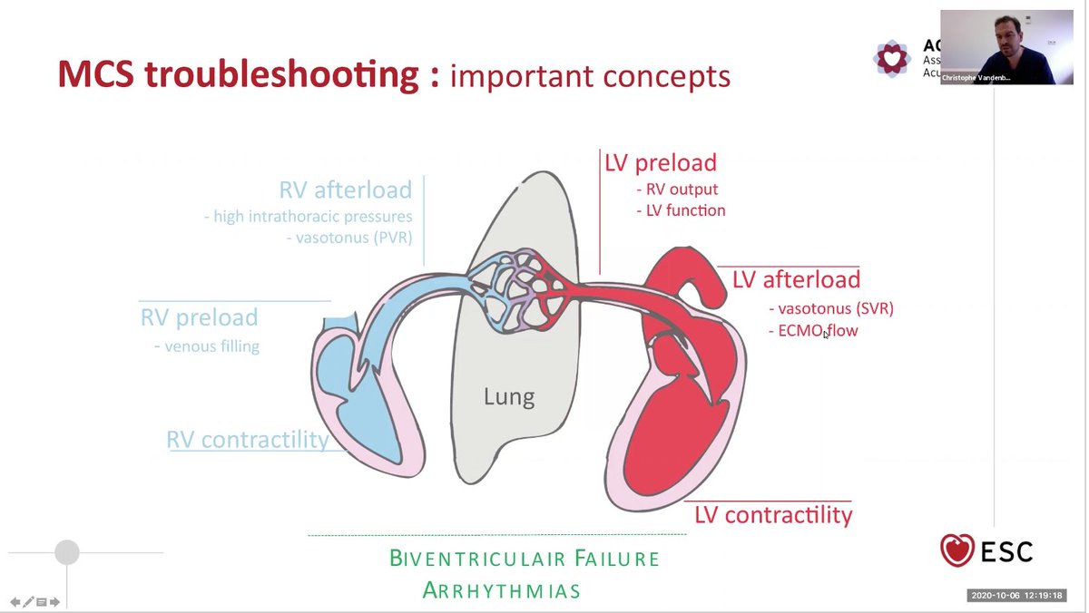 FOAMecmo's tweet photo. #AcuteCVDays week4⃣Mechanical Circulatory Support in CS/refractory CA
📽️ selection of @EuroELSO #ECMO #ECPR resources #EuroELSO2021 talks/webinars
📽️#ACVC2021 #MCS troubleshooting tips/tricks
📽️ACVC webinars
@escardio @ESICM @ERC_resus @EuropSocEM
&amp; more 🔗https://t.co/lpwOjARWDn https://t.co/esC3Akd1SO