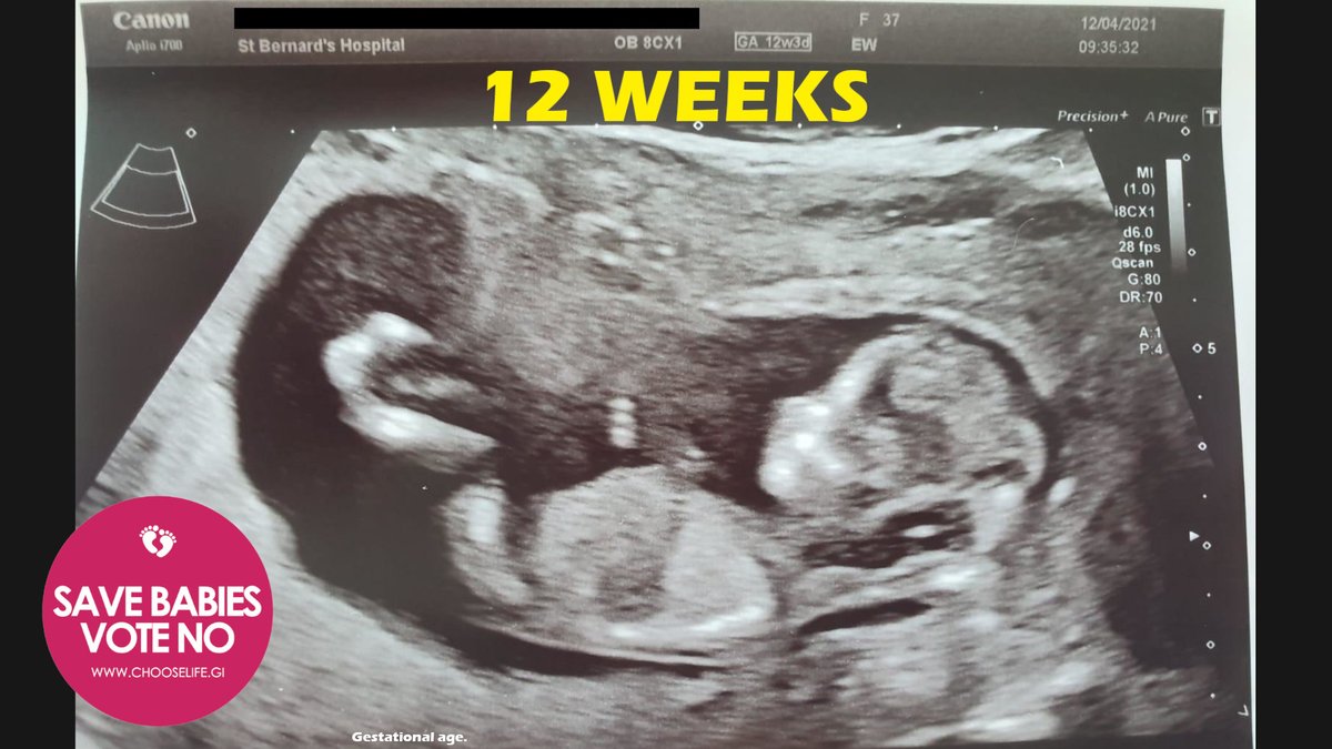 Gibraltar Pro-Life Movement tweet media