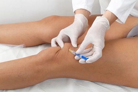 News: EULAR Guidelines on Intraarticular Therapy

EULAR has published evidence-based recommendations on the use of intra-articular therapies (IAT) based on the literature review and recommendations of a multidisciplinary international task force. 

bit.ly/3covoo7