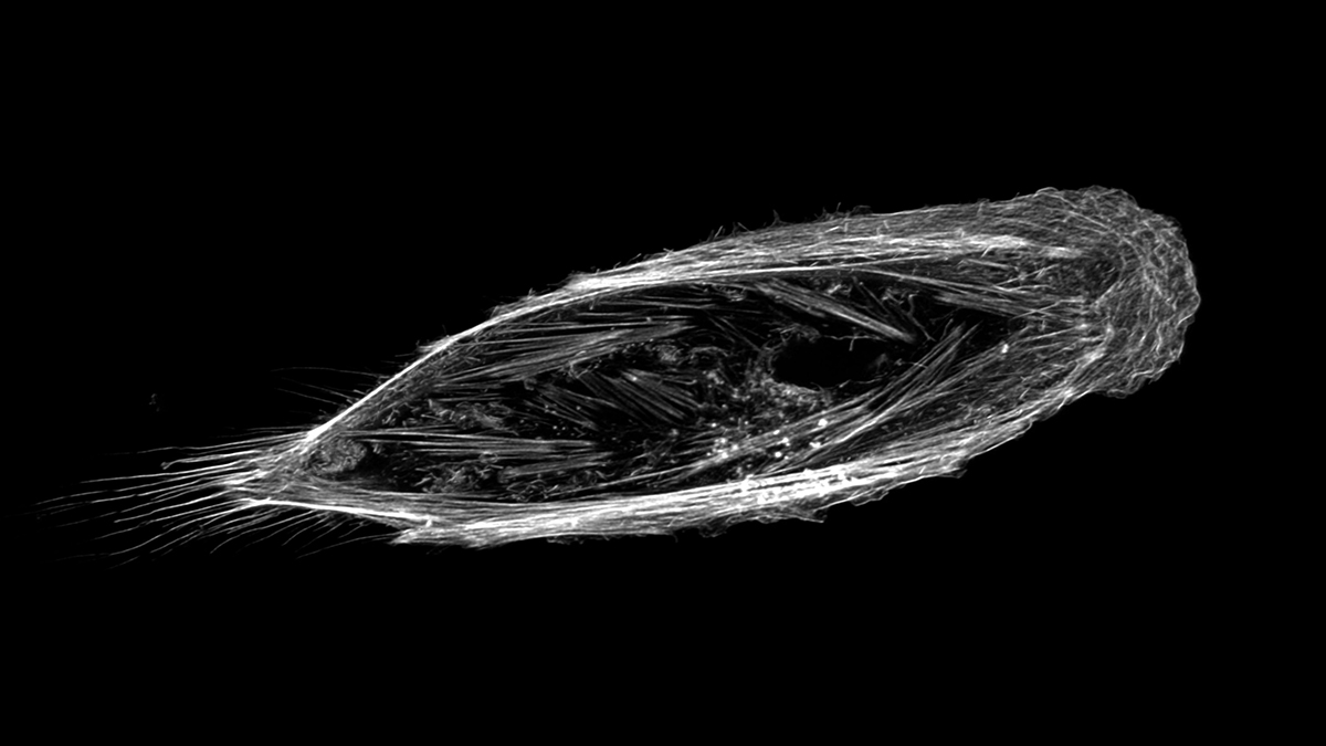 SciLifeLab (@scilifelab) on Twitter photo “I chose it due to the fact that it looks like some sort of primordial swimming organism while being completely something else” says <a href="/A_R_Agostinho/">Ana Agostinho</a> (SciLifeLab/<a href="/KTHuniversity/">KTH Royal Institute of Technology</a>) about this week’s #SciLifeLabArtTuesday image. More info about the image at: instagram.com/scilifelab/ “I chose it due to the fact that it looks like some sort of primordial swimming organism while being completely something else” says <a href="/A_R_Agostinho/">Ana Agostinho</a> (SciLifeLab/<a href="/KTHuniversity/">KTH Royal Institute of Technology</a>) about this week’s #SciLifeLabArtTuesday image. More info about the image at: instagram.com/scilifelab/