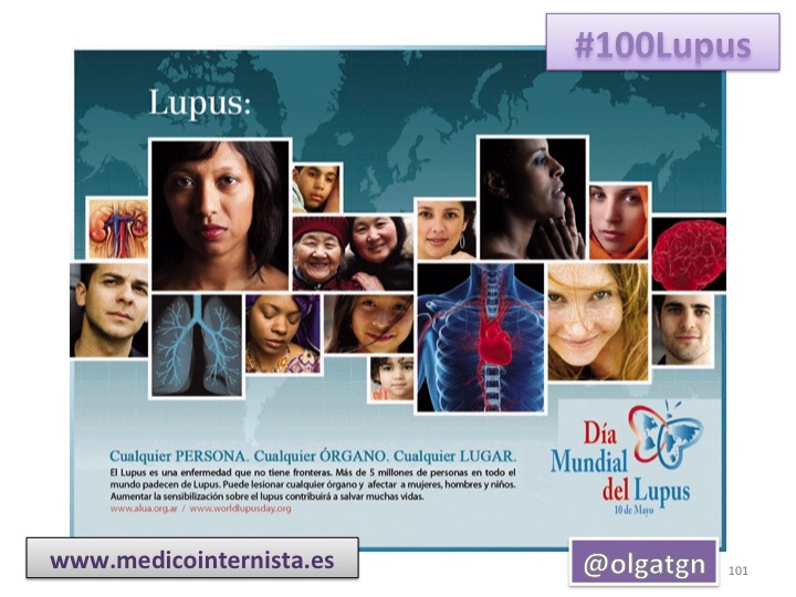 InternistaTGN's tweet photo. 💯#100Lupus ¡llegó al final!

Desde 2001 el 10 de mayo se celebra el DÍA MUNDIAL DEL LUPUS

     ...y mayo 2021 es #100Lupus

¡INFINITAS GRACIAS!

#LupusAwarenessMonth https://t.co/qRP7MPqzRb
