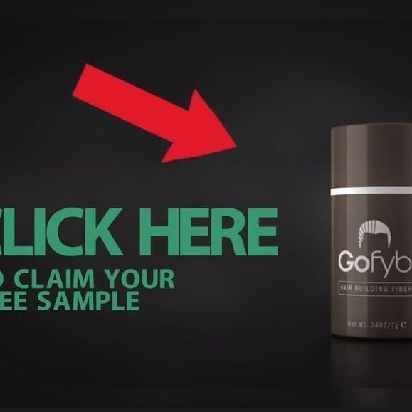 Gofybr - Hair Loss (@Gofybr) / Twitter Gofybr - Hair Loss (@Gofybr) / Twitter