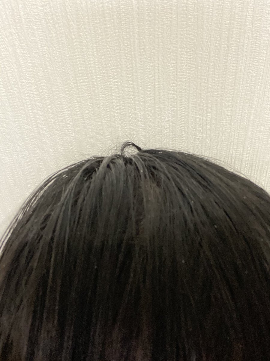 Asil V Twitter 湯シャン16日目は撮り忘れました 湯シャン17日目 1日洗わなかったら痒くて痒くて 掻いてしまいました 湯シャン してもフケが止まらない 左と真ん中 オイルで保湿してもう一度湯シャンして何とかいつも通り 右 湯シャン