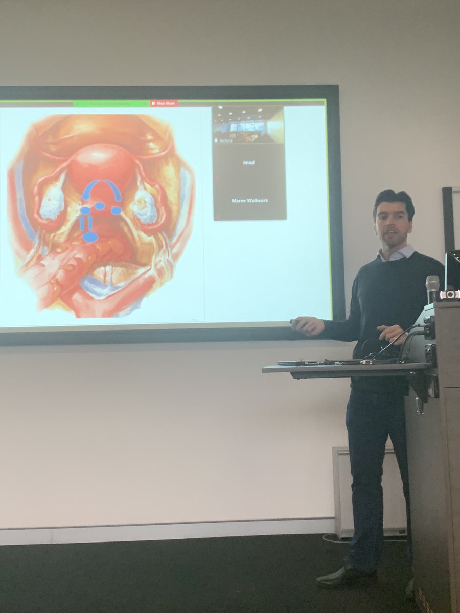 GeorgeCondous's tweet photo. ⁦@ManieriRocha⁩ presents at our monthly Colorectal-Gynaecological Endometriosis Multidisciplinary Service (CGEMS) meeting with ⁦@BartoWalid⁩ ⁦@Medtronic⁩ ⁦@jvzanardi⁩ https://t.co/459VZrKVkf