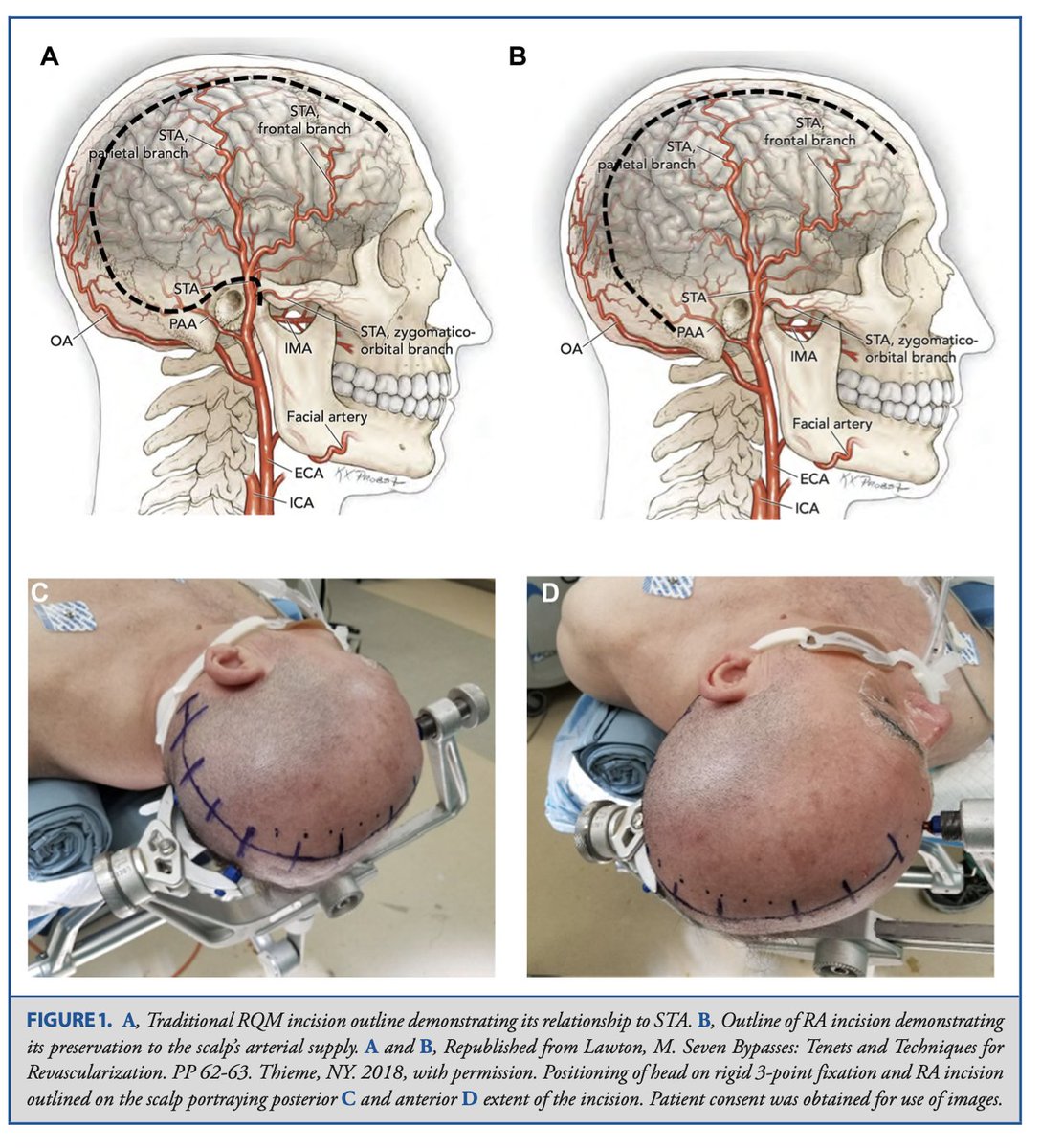 Martin Piazza tweet media