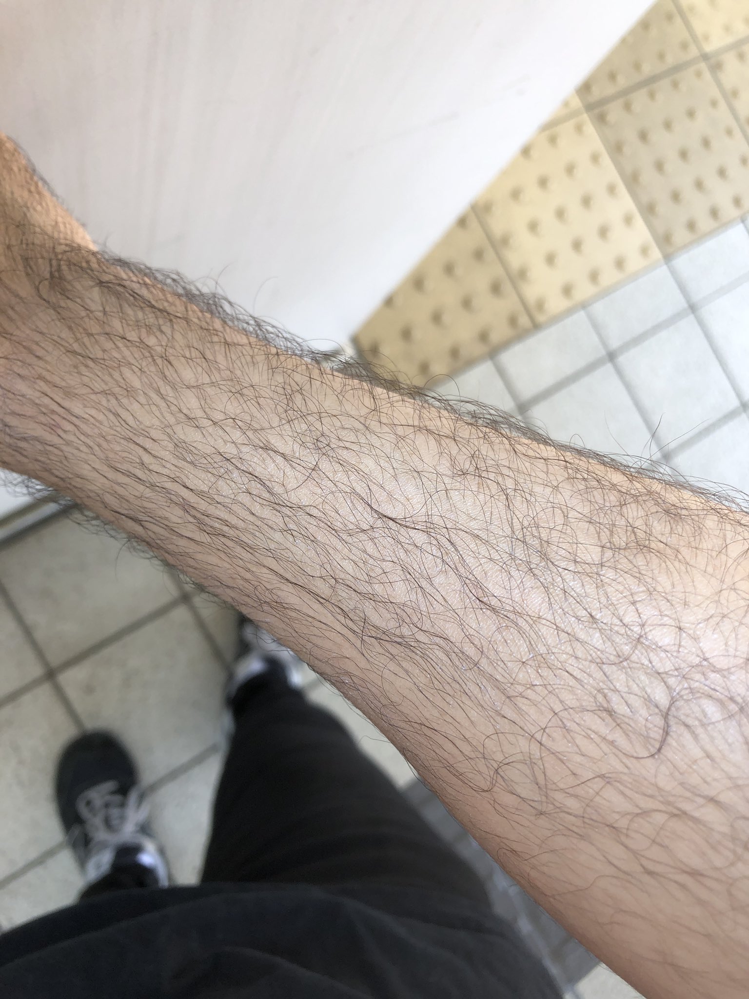 ひいち 腕毛に阻まれて日焼け止め塗れないんだが T Co Kfmh0hilop Twitter
