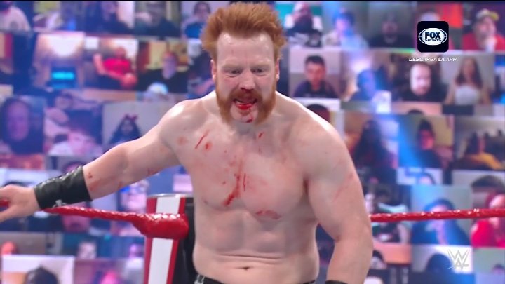 Update On Sheamus Suffering Broken Nose On WWE Raw 1