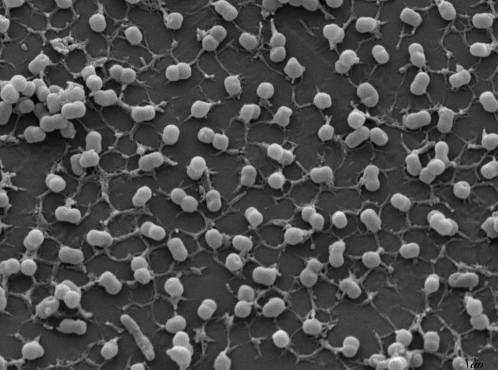 DRNaveenChetty's tweet photo. Early biofilm…
Acinetobacter baumannii cells in their early stages of biofilm formation, extending their extracellular matrix, longing to form a full-fledged biofilm #BiofilmsInTheLab #BiofilmAware  @ukbiofilms @BARCOD_biofilms @ScarabSheffield @HappyBiofilmer @Dhiviya56261355 https://t.co/VW4rM1tuB2