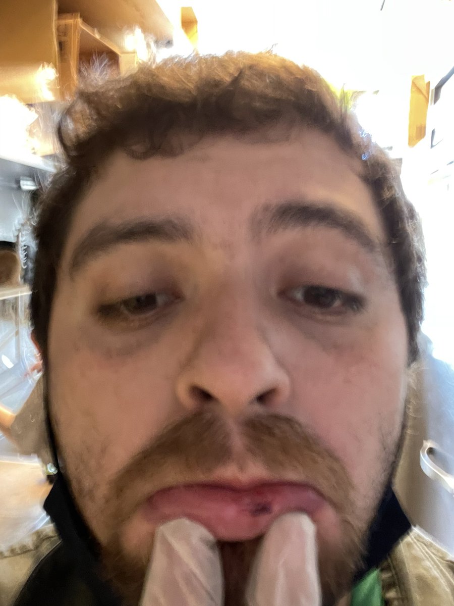 RayRayCruze's tweet photo. Lip looking sus #NeedSomeMilk https://t.co/NnYCTqzw5v