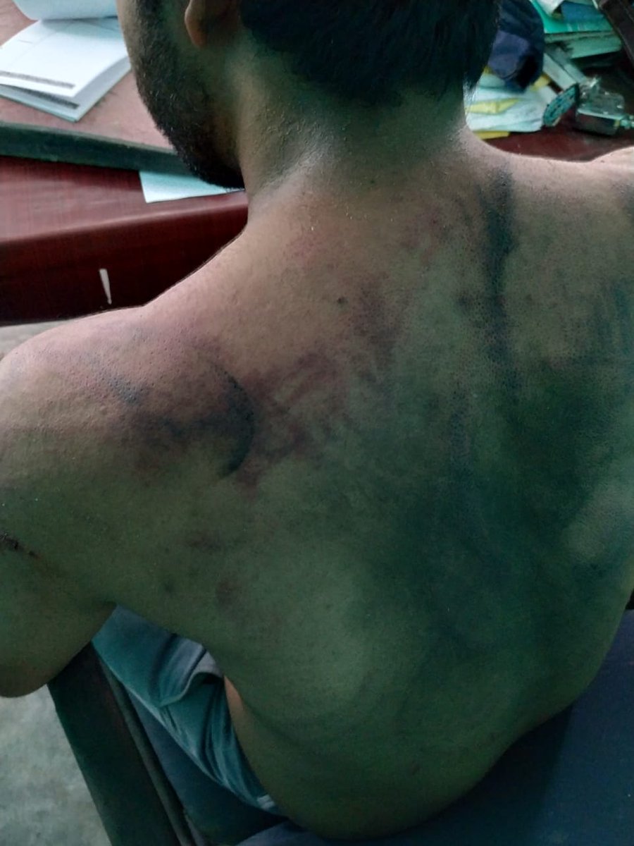 bora_jahnabi's tweet photo. Dr. Seuj Kumar Senapati, posted in Hojai, Assam, was assaulted by a group of attendants while he was on Covid duty. 
We want prompt action against the miscreants. Please look into this matter. 
@himantabiswa @keshab_mahanta 
#stopviolenceagainstHCPs
#stopviolenceagainstdoctors https://t.co/T3mwZ7jvz4