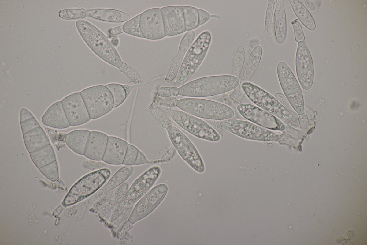 RPilze's tweet photo. Mastigosporium album ex Alopecurus pratensis

#Mastigosporiumalbum #Mastigosporium #Alopecuruspratensis #Alopecurus #WiesenFuchsschwanz #meadowfoxtail #Vulpindesprés #mushroom #mushrooms #fungus #fungi #pilz #pilze #champignons #champignon #nature #natur https://t.co/wdaffQa6SW