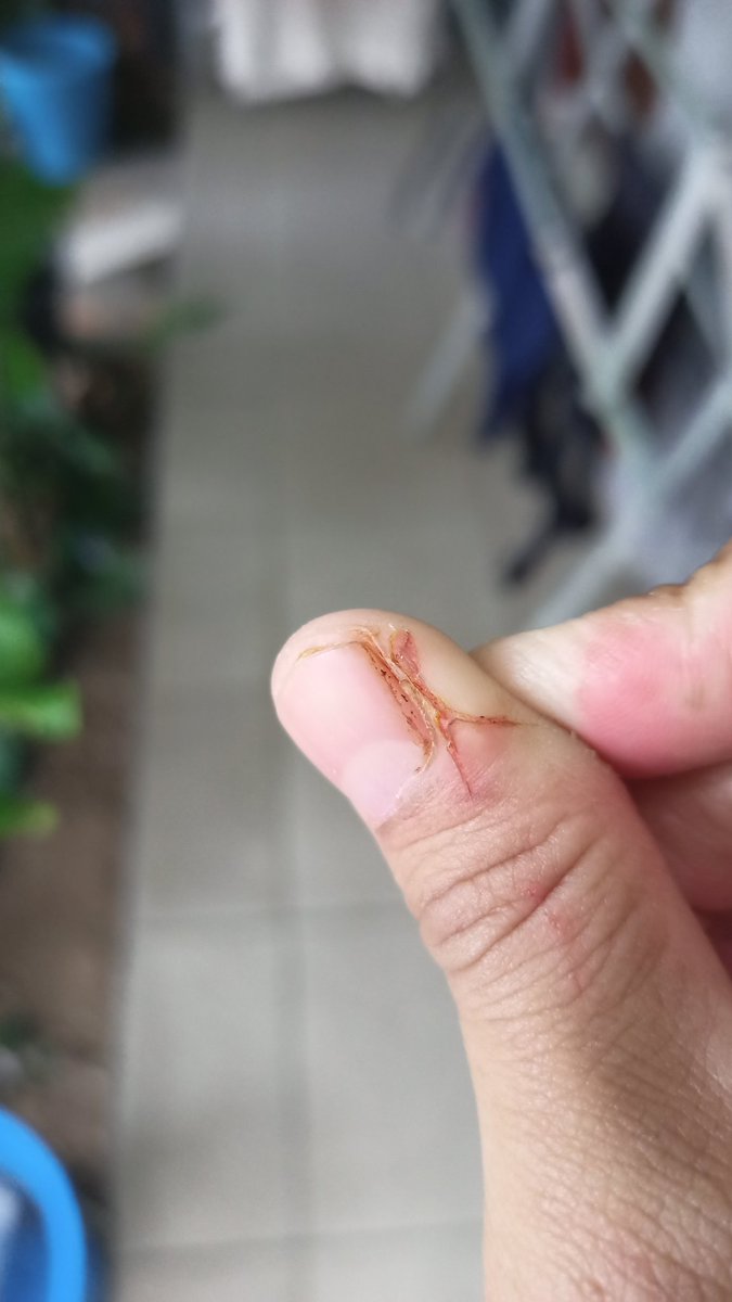 Paling males beset daerah kene 😑