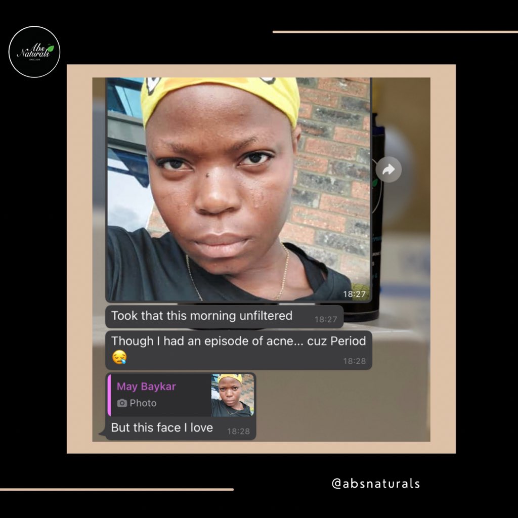 AbsNaturals's tweet photo. Progress reports are contents we love to see✨

We look forward to the many amazing results to come❤️
_
Your Skin’s Health, Our Concern. https://t.co/SiEwB4pMDK